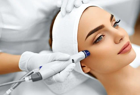 microdermabrasion