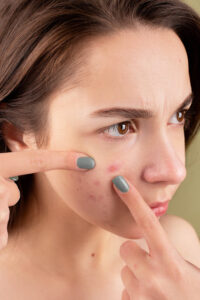 Read more about the article Ways Stress Affects Your Skin